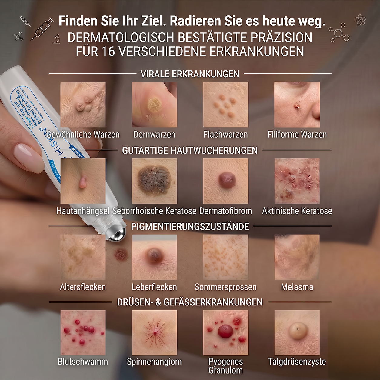 𝐇𝐈𝐒𝐊𝐈𝐍®👩‍⚕️⭐ 7-Tage-Hautmakel- & Hautanhängsel-Entferner Schmerzfreier Rollerball-Stift zur schonenden Entfernung von Hautanhängseln und Hautflecken – narbenfrei